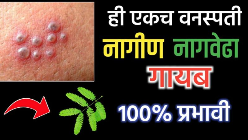 फक्त हि एकच वनस्पती आणि नागीण, नागवेढा होईल पूर्णपणे गायब; १००% प्रभावी.!