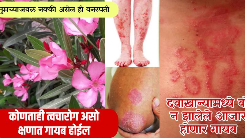 कसलाही त्वचारोग होईल मुळापासून गायब; अशाप्रकारे करा याचा उपाय.!