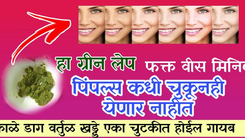 चेहऱ्यावरील काळे डाग, डोळ्याखालील काळी वर्तुळे, यासारख्या समस्या क्षणात दूर करणारा उपाय.!