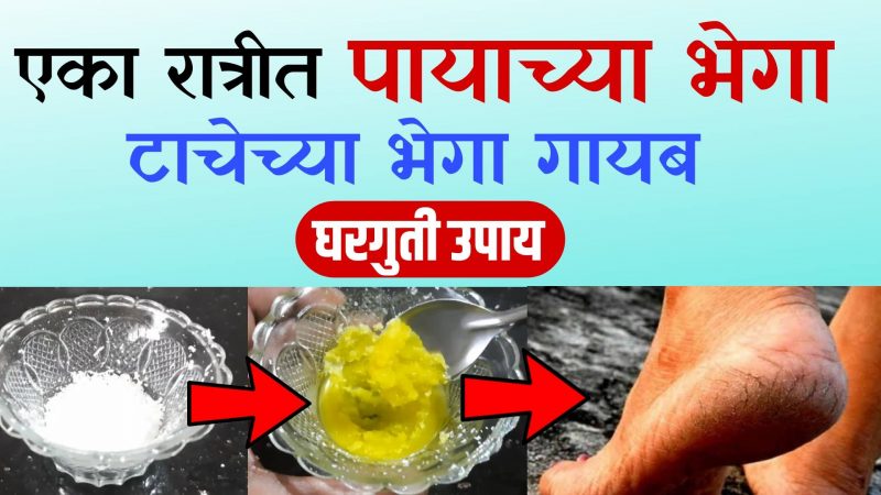 एका रात्रीतच पायांच्या भेगा गायब करणारा हा घरगुती उपाय एकदा नक्की करा.!