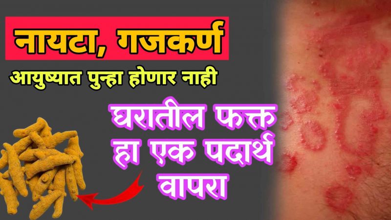 नायटा, गचकरण आयुष्यात पुन्हा कधी होणार नाही; वापरा घरातील फक्त हा १ पदार्थ.!