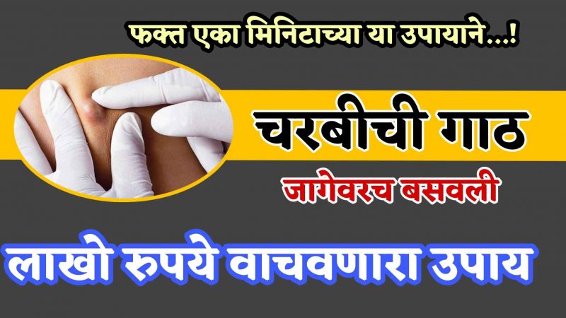 फक्त १ मिनिटांचा हा उपाय चरबीची गाठ जागेवरच बसेल; लाखो रुपये वाचवणारा उपाय.!