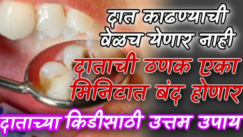 दुखणाऱ्या दातांवर हे फक्त ५ मिनिटे ठेवा; खात्री देतो दात काढण्याची वेळच येणार नाही.!