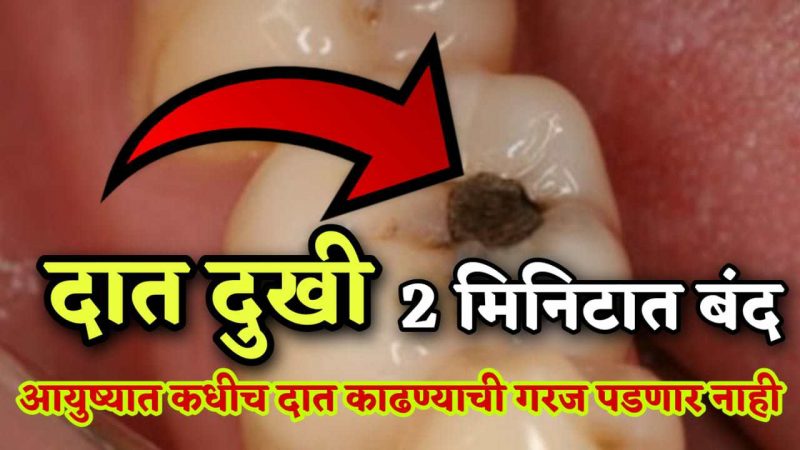 जेवणानंतर फक्त हा एक उपाय करा; दात दुखी ५ सेकंदात होईल बंद, आयुष्यात दात काढायची गरजच लागणार नाही.!