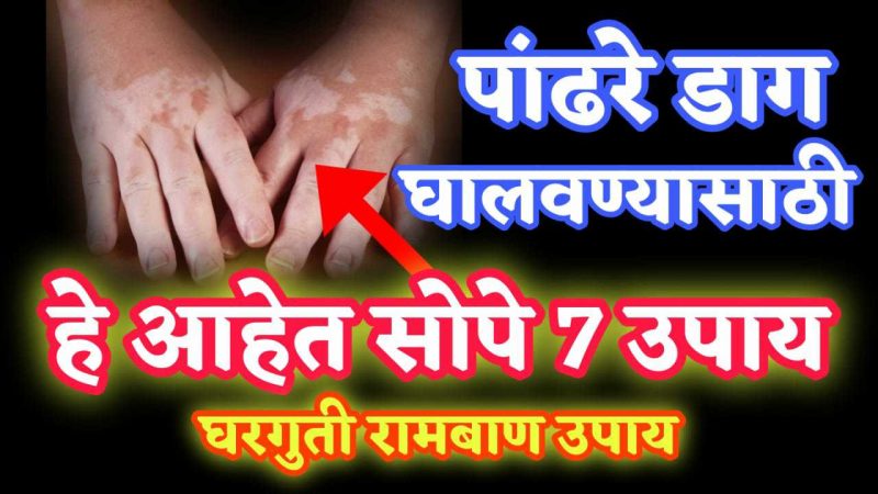 शरीरावरील पांढरे डाग, कोड घालवण्यासाठी हा रामबाण उपाय एकदा नक्की करा; एकही डाग शरीरावर राहणार नाही.!