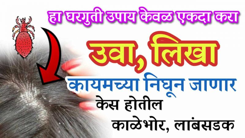 हा १ घरगुती रामबाण उपाय केल्याने उवा कायमच्या निघून जातील; केस पण होतील लांब व काळेभोर.!