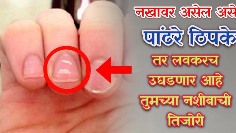 जर तुमच्याही नखांवर पांढरे ठिपके असतील तर समजून जा लवकरच तुमच्या नशिबाची तिजोरी उघडणार आहे.!