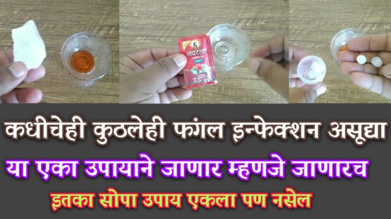 कुणाचीही आणि कुठलीही खाज, खरूज, नायटा या उपायाने हमखास होईल कायमची नष्ट.!