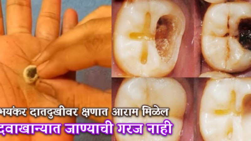 दात दुखी होईल क्षणातच बंद; हिरड्यांची सूज होईल रात्रीत गायब, करा हा सोप्पा घरगुती उपाय.!