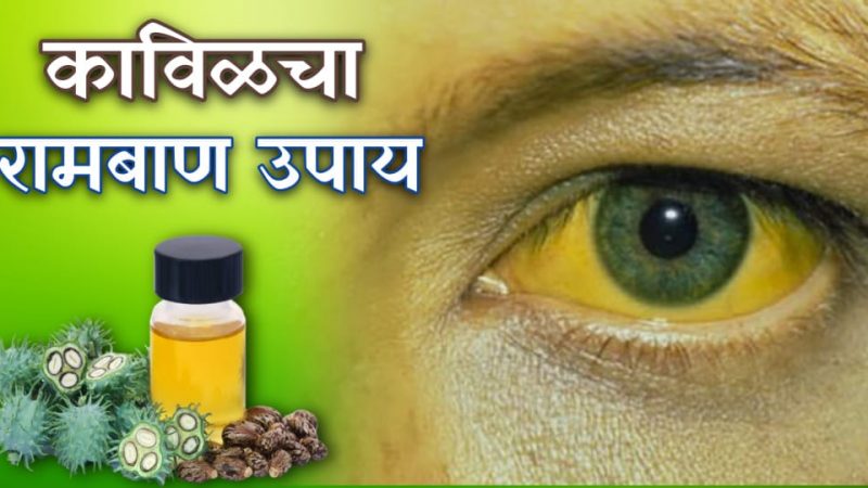 कावीळ झालेल्या लोकांसाठी एखाद्या रामबाण औषधापेक्षा कमी नाहीय हा घरगुती उपाय.!