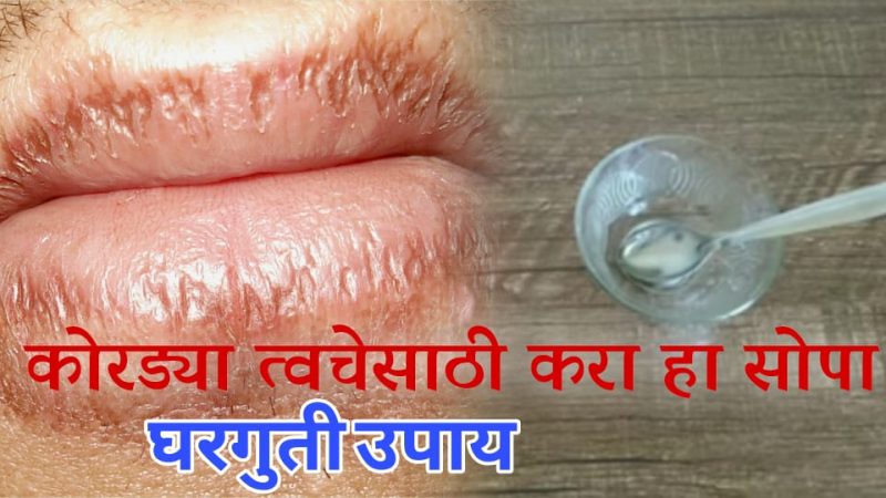 फाटलेले ओठ, उकललेल्या टाचा, काळे घोटे, उकललेली त्वचा यांवर अत्यंत प्रभावशाली घरगुती असा उपाय.!