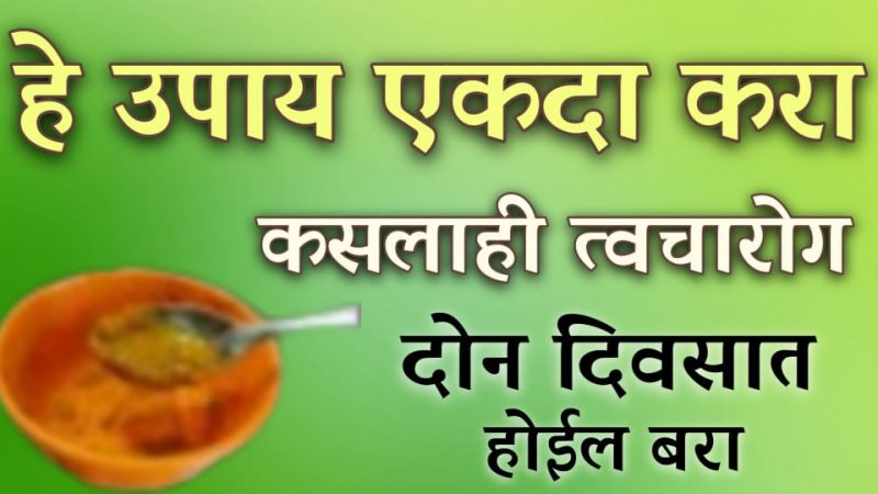 हे 2 उपाय सोबतच केल्यास कसलाही त्वचारोग मुळापासून बरा होतो; खाज, खरूज, गजकर्ण याचा होईल नायनाट.!