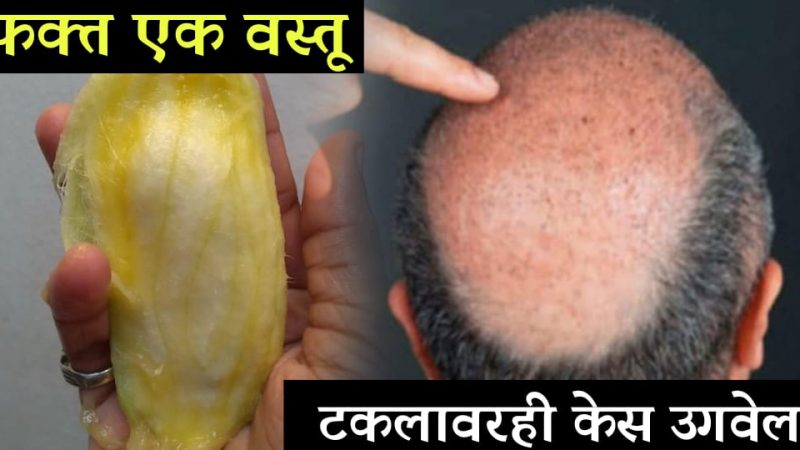 टक्कलवर केस आणणारी ही वस्तू फेकण्यापूर्वी हा लेख एकदा जरूर वाचा.!