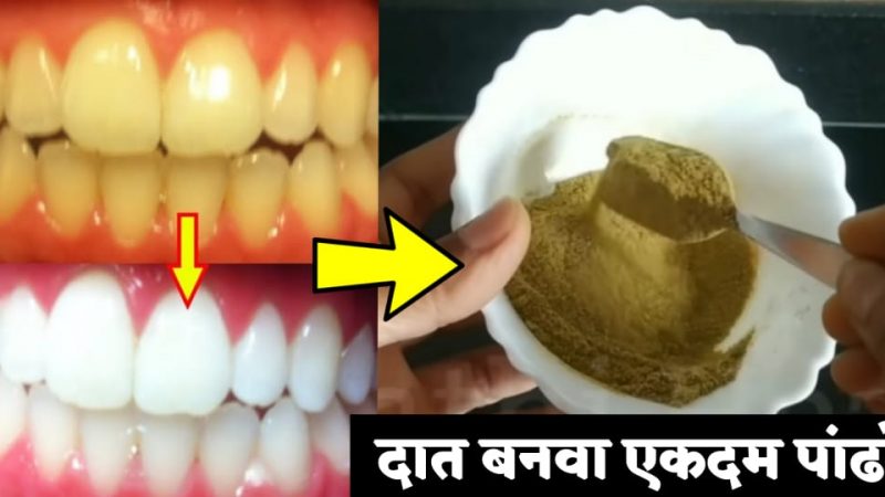 पिवळ्या दातांवर हा पदार्थ घासा; पिवळे झालेले दात अगदी मोत्यासारखे चमकू लागतील.!