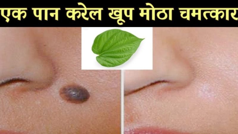या पानाच्या वापराने तुमच्या चेहऱ्यावरील तीळ व मोस एका झटक्यात होतील नष्ट.!