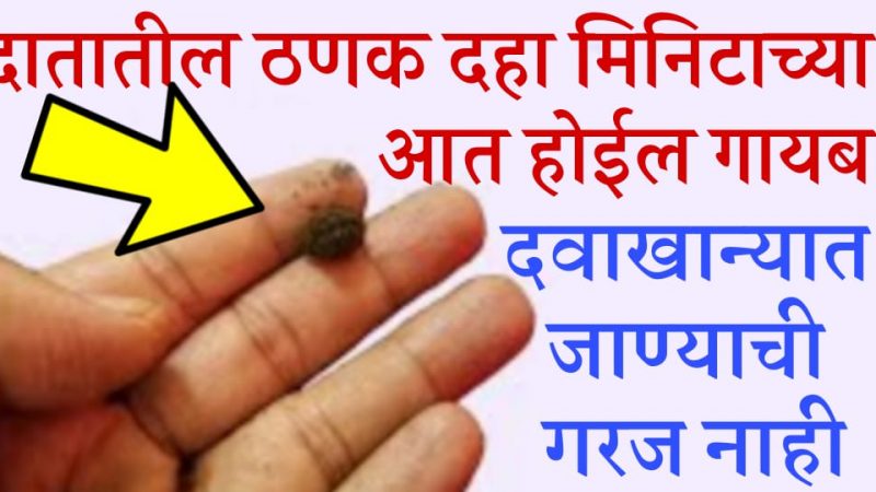दुखऱ्या दाताखाली ठेवा ही गोळी; कोणत्याही ठणकणाऱ्या दाताला 5 मिनिटात मिळेल आराम.!